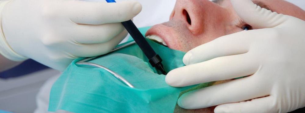 Root Canal Treament and Care, Orange, California