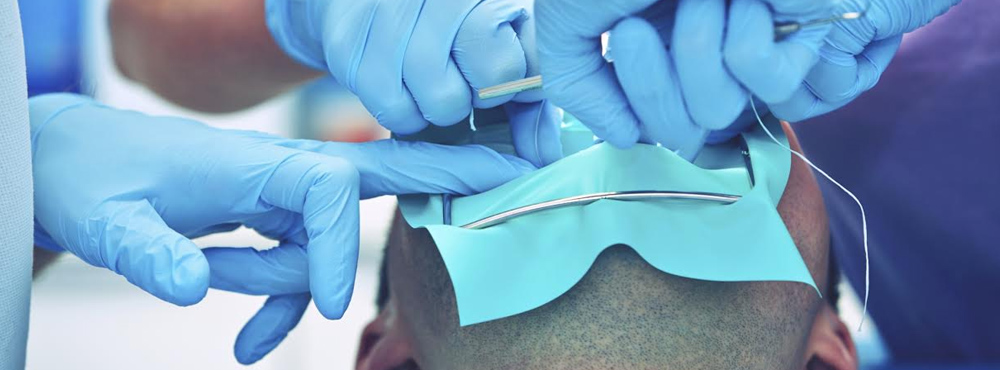 Oral Surgery Dentist - Dr. Seini - Orange, California